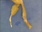 tendondetache.jpg